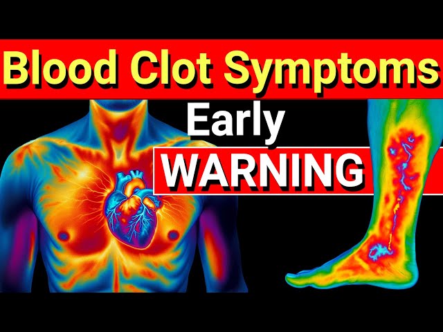 5 Hidden Blood Clot Symptoms: Don't Miss These Warning Signs