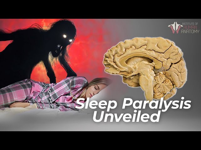 Sleep Paralysis | The Waking NIGHTMARE
