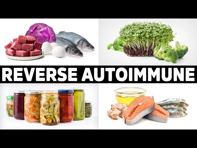 The 5 Best Ways to Treat Autoimmune Disease Naturally