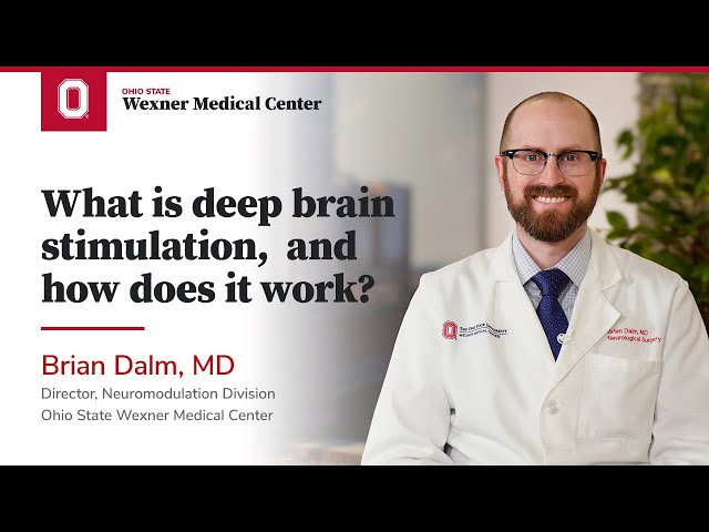 What is deep brain stimulation, and how does it work? | Ohio State Medical Center