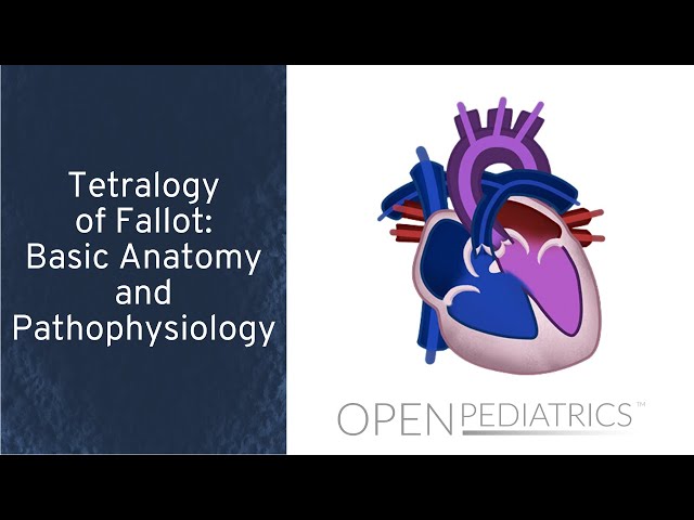 Tetralogy of Fallot: Basic Anatomy and Pathophysiology by P. Lang, L. DelSignore | OPENPediatrics