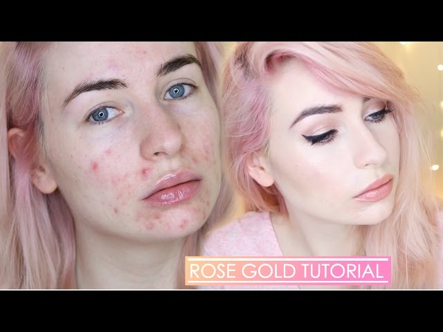 ROSE GOLD MAKEUP TUTORIAL | Full Face with acne