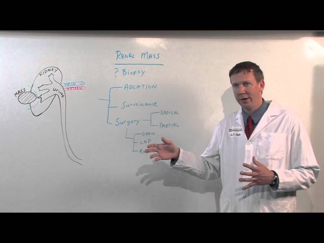 Treatments for Kidney Tumors - Kenneth Nepple, MD