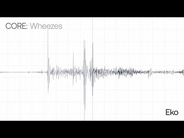 Wheezes Recording & Waveform | Eko Health