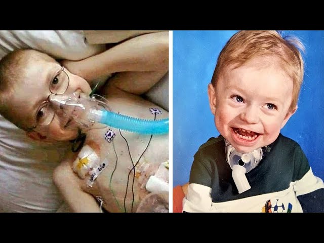 Boy born with organs outside of his body, survives and celebrates high school graduation
