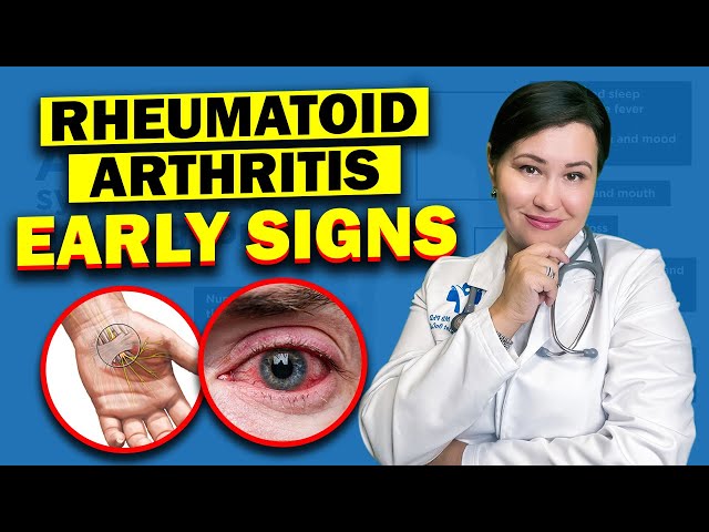Early Warning Signs Of Rheumatoid Arthritis | Don't Ignore These Vital Symptoms!