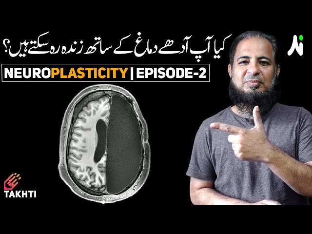 The Girl With Half Brain | Neuroplasticity | Episode-2  | اردو | हिन्दी