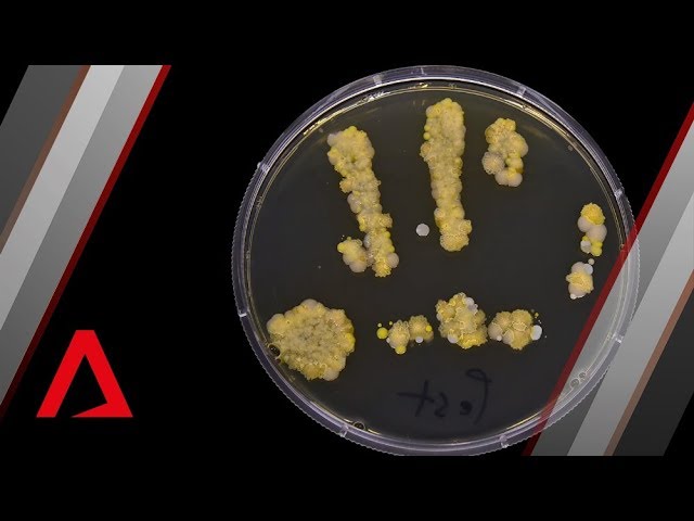 The bacteria living on your hands right now