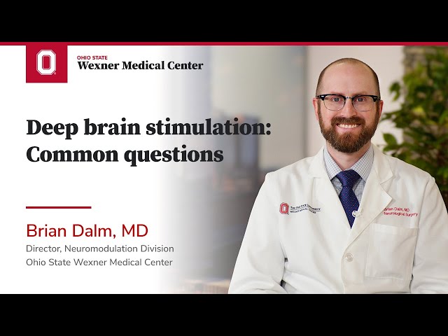 Deep brain stimulation: Common questions | Ohio State Medical Center