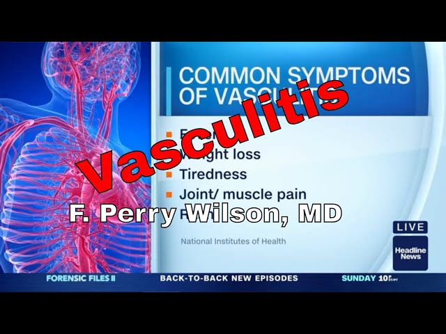 What is Vasculitis?