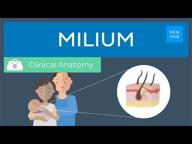 Milium: Definition, symptoms, treatment and management | Kenhub
