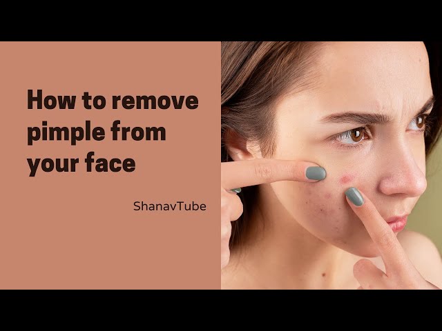 How to remove pimples from face | how to remove pimples | treatment for pimple | pimples | skin care