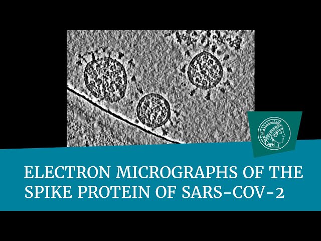 Electron micrographs of the spike protein of Sars-CoV-2