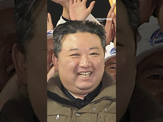 Kim Jong-un's white hair...