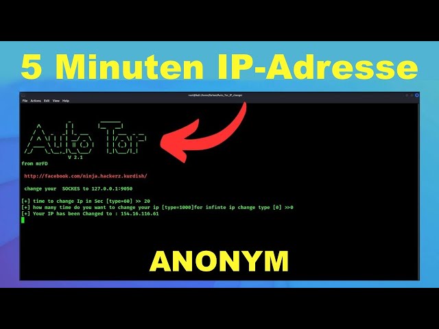 Automatisch IP-Adresse alle 5 Min ändern! [Anonym]