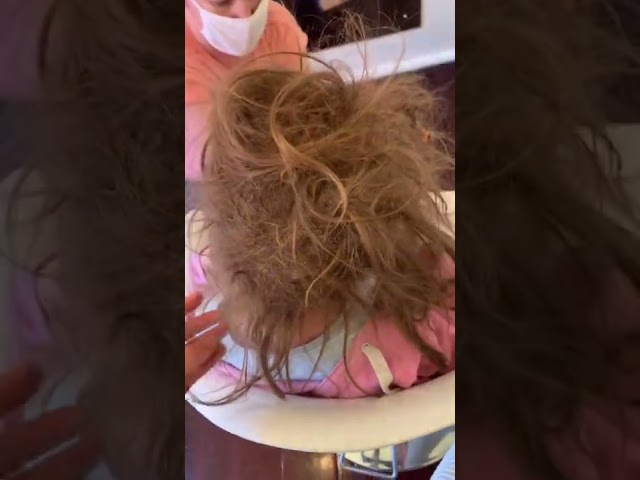 Hairdresser shares horrific LICE INFESTATION on girl's head  Part Two