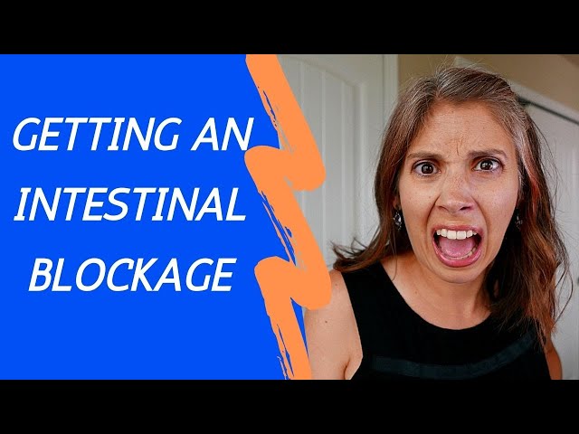 My Story: Getting an Intestinal Blockage