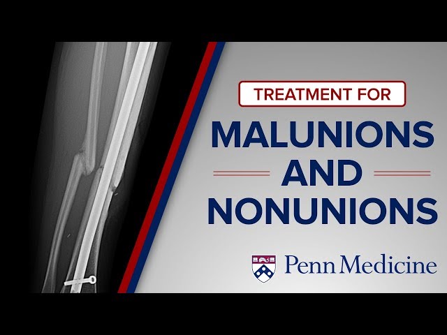 Emerging Techniques for Malunions and Nonunions | The Penn Orthoplastic Limb Salvage Center