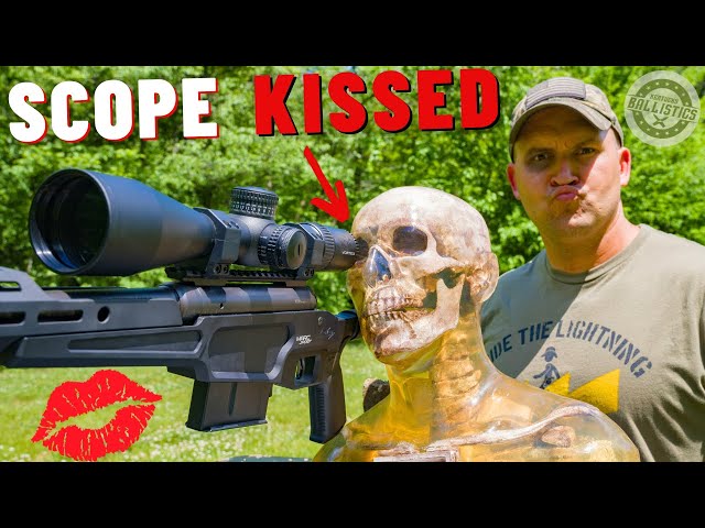 SCOPE KISSES 💋 (How Dangerous Are They ???)