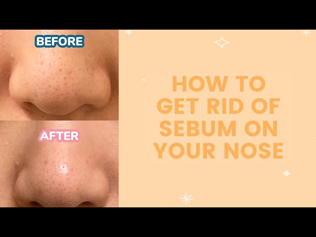 How to Get Rid of Sebum On Your Nose | FaceTory