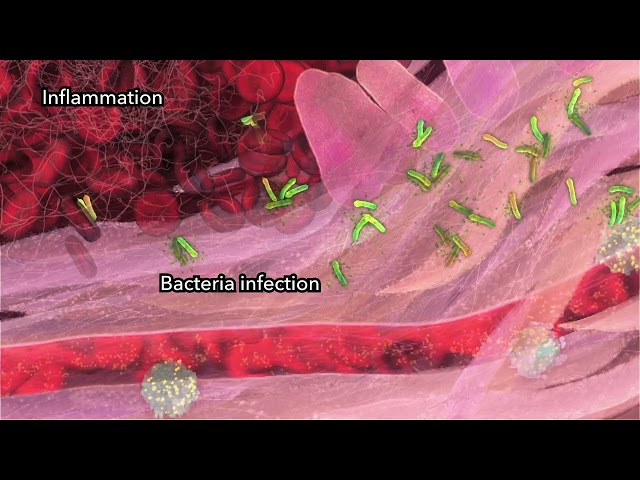 Skin Wound Inflammation (Narrated, 2014) by Drew Berry wehi.tv