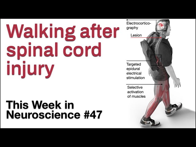 TWiN 47: Walking after spinal cord injury