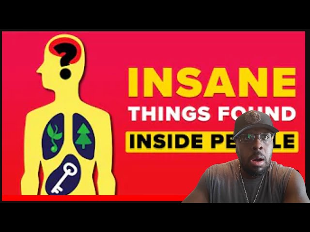 THE INFOGRAPHICS SHOW: SHOCKING UNEXPECTED THINGS THAT WERE FOUND INSIDE PEOPLE REACTION...