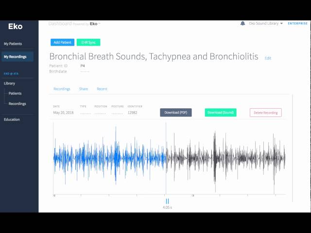 Bronchial Breath Sounds, Tachypnea and Bronchiolitis Recording & Waveform | Eko Health