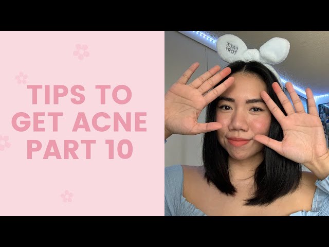 Tips to Get Acne #10 | FaceTory