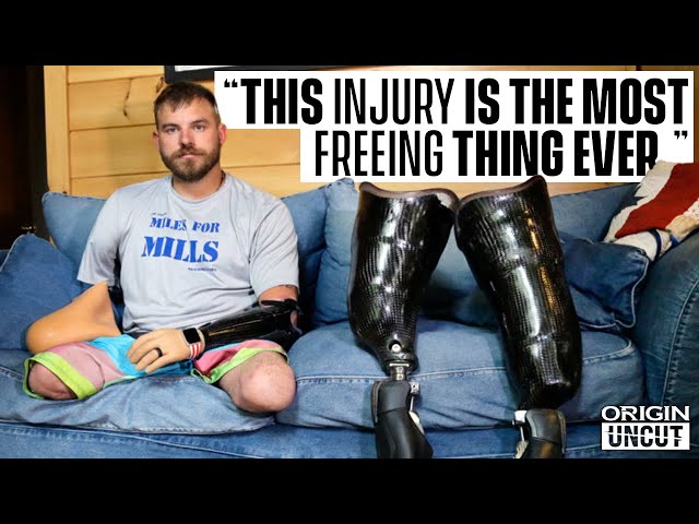What This Quadruple Amputee Has Learned From His Injuries | SSG Travis Mills