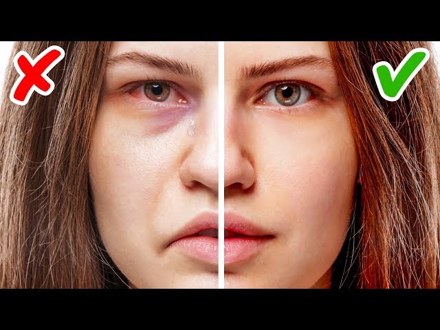11 Zeichen für Gesundheitsprobleme, erkennbar an deinem Gesicht
