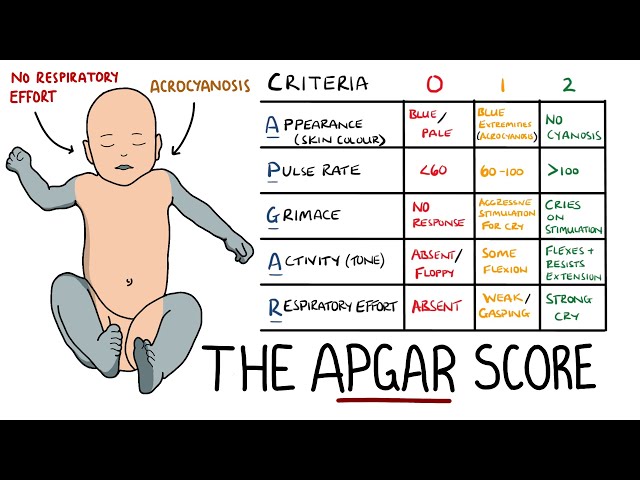 APGAR Score Made Easy - Newborn Assessment (APGAR Mnemonic)