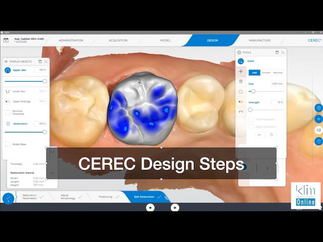CEREC Software 5 Step Design Workflow