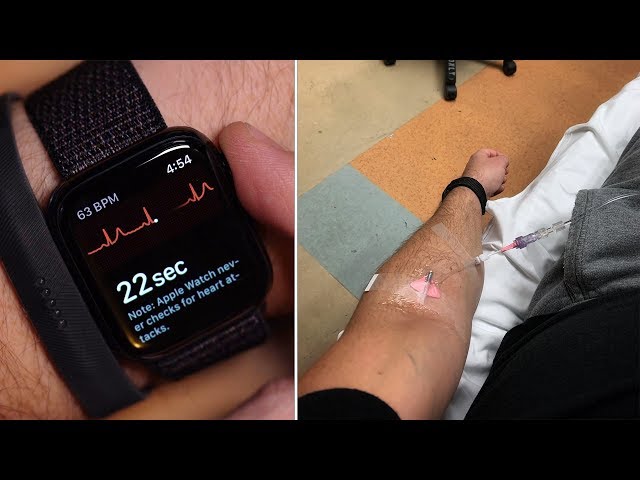 How an Apple Watch ECG Led Me To The Emergency Room