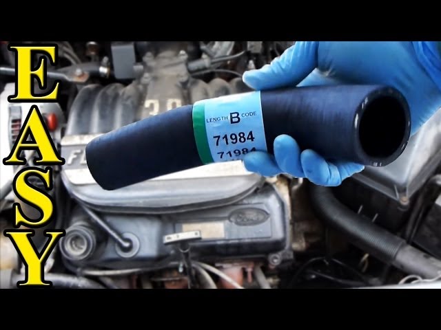 How to Replace a Radiator Hose (Upper and Lower)