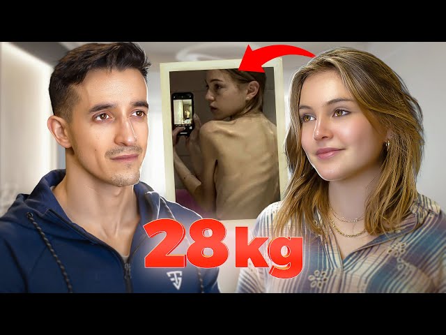 She weighted 28kg : her fight against sickness !