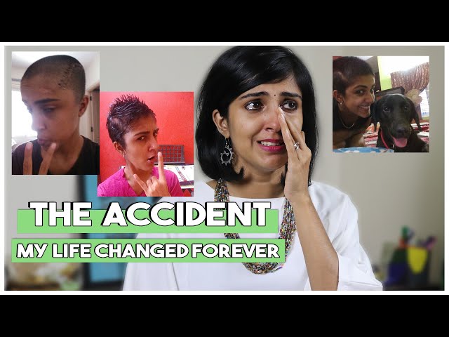MY ACCIDENT STORY! Hospital Time, Recovery, Finding Love, Losing Job..