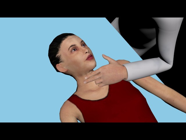 Carotid Sinus Massage technique - VAGAL MANEUVER TECHNIQUE