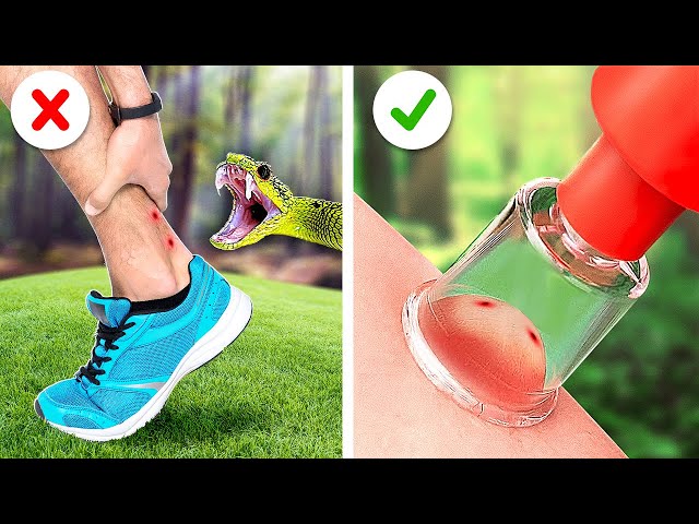 OMG! HOW TO SURVIVE IN THE WILD || COOL VACATION TIPS AND CAMPING HACKS