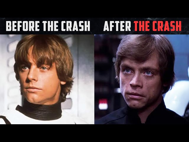 This is why Luke's face changed after «A NEW HOPE» (Terrible crash)
