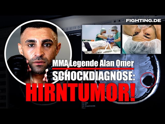 Durch die Welle - Die krasse Geschichte von MMA-Legende Alan Omer und den Kampf gegen den Hirntumor