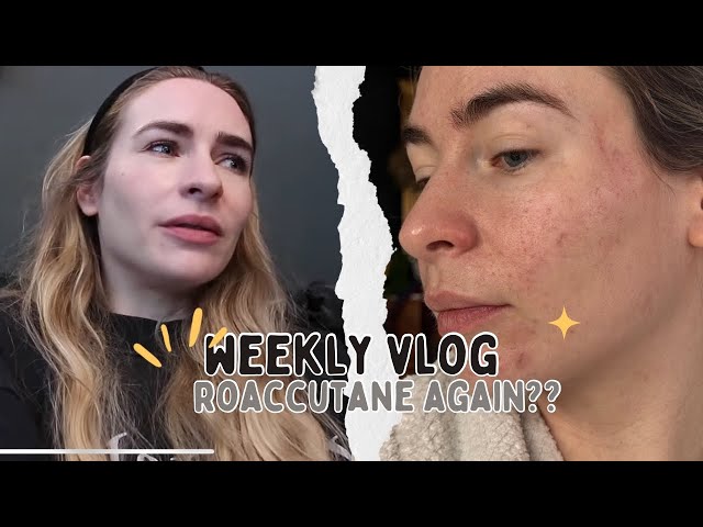 Going on Roaccutane again? | Weekly Vlog