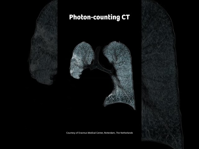 Photon-counting CT