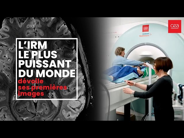 A world premiere: the brain revealed as never before thanks to the world’s most powerful MRI machine