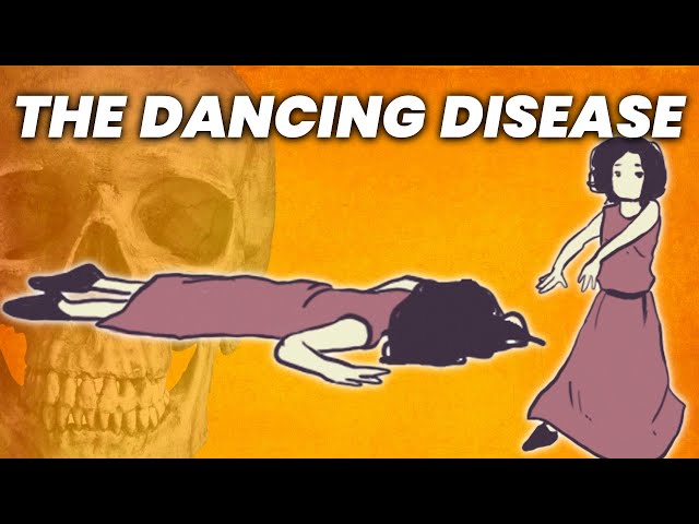 The Disease That Made People Die from Dancing