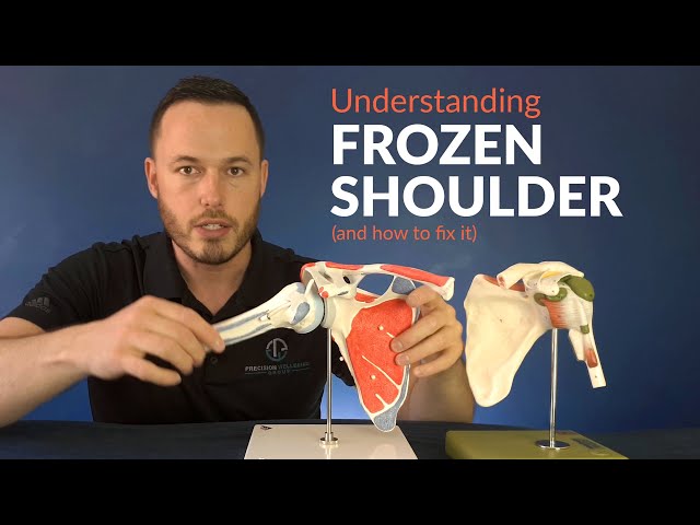 Understanding FROZEN SHOULDER and how to stretch for greater movement