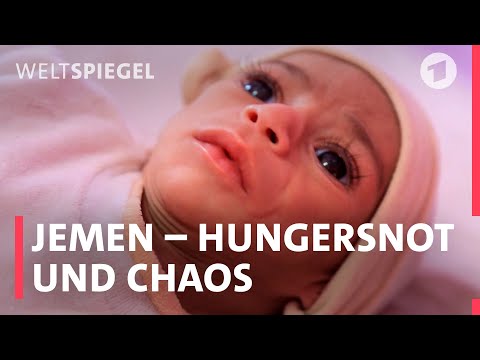 Hungersnot und Chaos: Der vergessene Krieg in Jemen