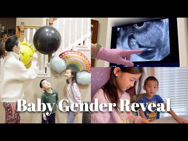 First Ultrasound | Telling Our Kids I'M Pregnant | Gender Reveal
