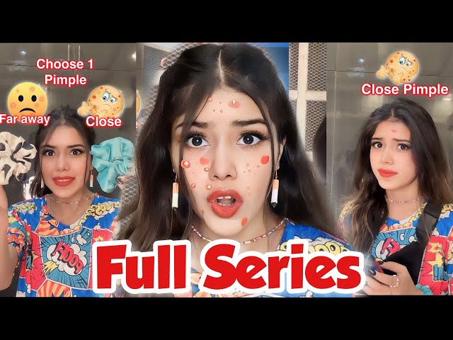 Full Series ~ If your PIMPLE 🔴Decides your Future Husband!