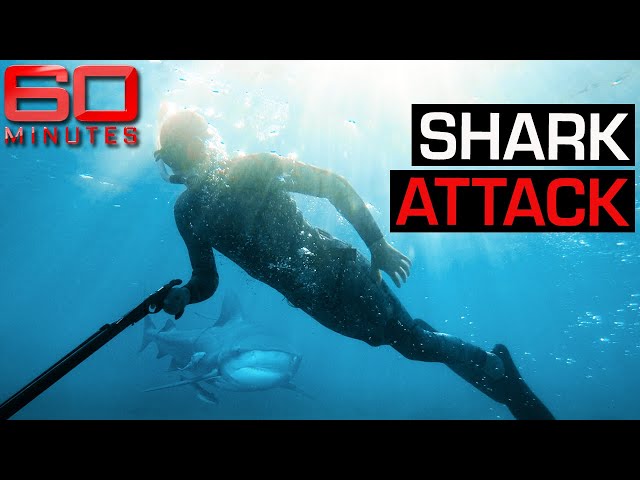 Young man attacked by a shark three times loses his leg | 60 Minutes Australia